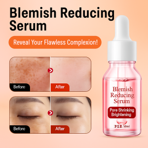 377 Whitening Spot Removal Essence for All Year Round Beauty Care for Adults  Diminish Dark Spots  Brighten Dull Skin  Minimize Pores