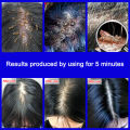 Head Lice Removal Shampoo Anti Lice Shampoo for Kids Adults Kuto and Lisa Remover Shampoo with Comb Head Lice and Egg Remover Effctive Head Lice Treatment Para Sa Kuto Kwell Shampoo Anti Kuto Mild Anti-dandruff Anti-itching Oil-control Fluffy Shampoo. 