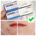 Derma Forte 15g CHÍNH HÃNG Kem Chấm Mụn Giảm Mụn Giảm Vết Thâm - Gel Ngừa Mụn Cao Cấp, gom cồi mụn nhanh chóng. 