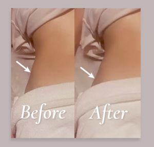 Skin Inc The Super Summer Glow Sculpt Ritual | Tri-Light™ Body Sculpt Fit + Cryo-Ice Sake Roller | Firm Lift & De-Puff