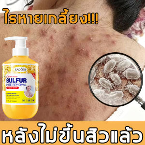 ครีมอาบน้ำ ครีมอาบน้ำกำจัดไร 500ML เจลอาบน้ำ สูตรสมุนไพร กำจัดไร ล้างผิวสวยไร้ไรฝุ่นยับยั้งไร ลบสิว ป้องกันผิวแห้งกร้าน ควบคุมความมัน ขจัดไรและสิว