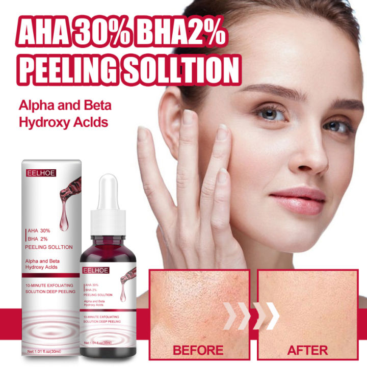 Dung Dịch Lột Da Mặt AHA 30% + BHA 2% Axit Salicylic Axit Trái Cây ...