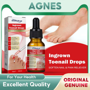 South Moon Nail Repair Liquid Rotten Toenail Bad Nail Remove Onychomycosis Cleaning Deep Repair Nail Fungus Treatment Liquid Ingrown Toenails Repair Serum Drop Nail Correction Recover Oil Paronychia  Pain Relief Treatment Feet Health Care(10ml)