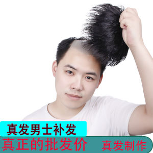 Mens reissue piece wig cover top reissue forehead bald reissue pad hair extension flip cover wig mens hair block