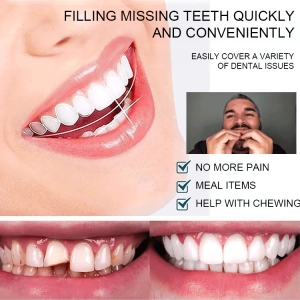 Denture Veneers for Men and Women Perfect Jaw Veneers The Secret Weapon for a Cosmetic Smile