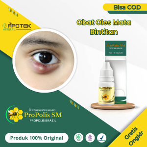 Obat Untuk Mata Bintitan Benjolan Kalazion Obat Penghilang Benjolan di Kelopak Mata - Propolis SM