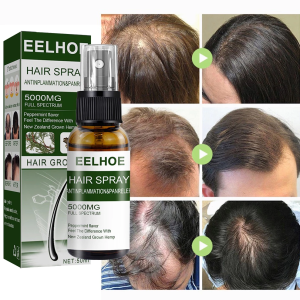 EELHOE Xịt Mọc Tóc Giảm Rụng Tóc Và Kích Thích Mọc Tóc
