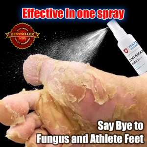 Smelly Feet Spray Herbal Anti-fungal Foot Spray 30ml feet deodorant spray Say Bye to Fungus and Athlete Feet for a Healthy Feet