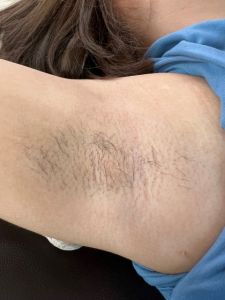 แว๊กซ์กำจัดขน 240g - คลิกที่เครื่องดื่มแบบวงการ ขนาด 240g