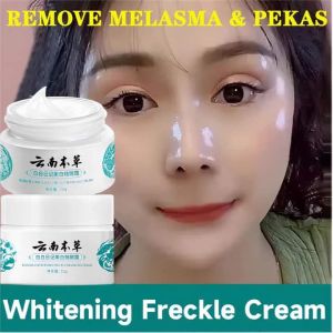 2023 HOT JAPANESE Melasma Cream White Spot Cream Skin Care Face Moisturizer Freckle Whitening Cream
