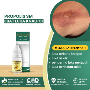 Obat Luka Terkena Knalpot Obat Untuk Luka Knalpot Obat Luka Bakar Kena Knalpot Obat Penghilang Bekas Luka Bakar Obat Pengering Luka Melepuh Obat Luka Perih Dan Sakit - Propolis SM