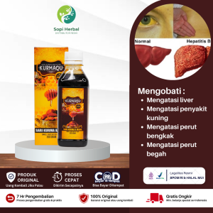 Obat Liver Hati Sirosis Obat Hepatitis A B C D E Penyakit Kuning Mata Anak Dewasa Perut Membesar Pada Anak Dengan Sari Kurma Kurmaqu