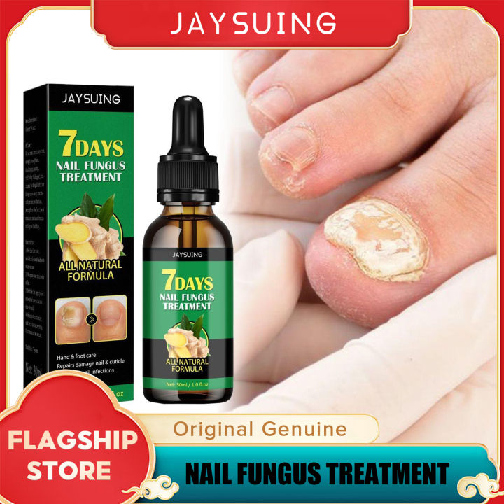 Jaysuing 7DAYS Nail Fungus Treatment Essence Serum Nail Repair