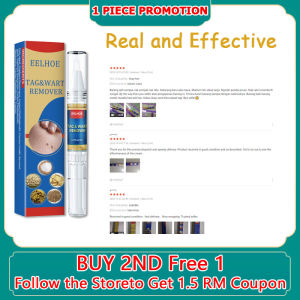 Ubat ketuat Buang tahi lalat dan kutil Biji kolestrol remover wart removal liquid pen Removal Melanin Spots