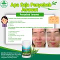 Obat Jerawat dan Bekas Jerawat Paling Ampuh BPOM / Herbal Penghilang Jerawat Alami Bersih Dari Dalam De Nature. 