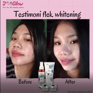 Jglow Skincare Paket spot whitening / Perawatan Wajah Flek Whitening / ORIGINAL / TERLARIS / BEST SELLER / SUBANG