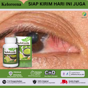 Vitamin Untuk Mata Ptregium Kekuningan Obat Mata Berlemak Keloreena Ekstrak Daun kelor