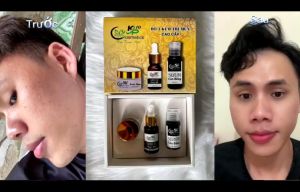 Hết mụn khôi phục da chỉ sau 1 liệu trình - sử dụng được cho da nhạy cảm.