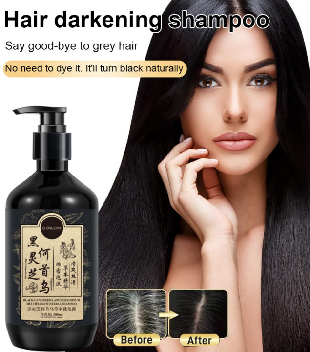 bungee Anti-dandruff, anti-itch and oil-control shampoo with ginger and ...