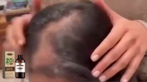 WoodSleep Skin Care Castor Oil Moisturizing Repair Hydrating Nourishing Hair Follicle Care Smooth Multi-Effect Essence