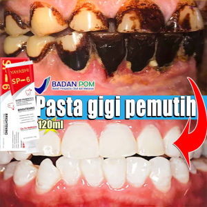 SP-6 Pemutih Gigi Kuning Dan Karang Probiotik Memutihkan Gigi Kuning Penghilang Karang Gigi Dan Pemutih Gigi Permanen