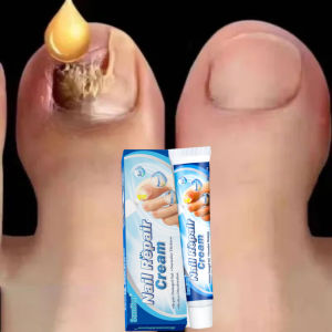 Nail Repair Krim Original Krim Kuku | Perawatan Kuku Berjamur | Krim Penghilang Jamur Di Kuku | Vitamin Kuku Rusak | Memperbaiki Kuku Rusak