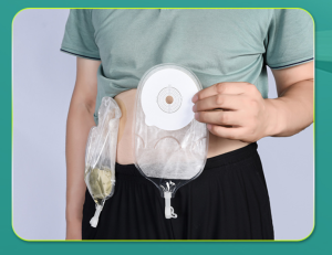 Túi nước tiểu nhân tạo 1 mảnh