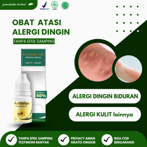 Obat Alergi Berkepanjangan Bentol Gatal Muncul Bercak Merah di Kulit - Propolis SM Brazilian