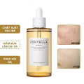 CHÍNH HÃNG✨ Serum SKIN1004 Madagascar Centella Ampoule 100ml Phục Hồi Da Tinh Chất rau má. 