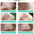 LANBENA Komedo Blackhead Remover Cream Masker + 60pcs Paper / Cream Komedo. 