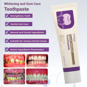 Whitening and Gum Care Toothpaste Remove Stains Yellow Teeth and Tartar Toothpaste Fresh Breath Restoring Damaged Gums