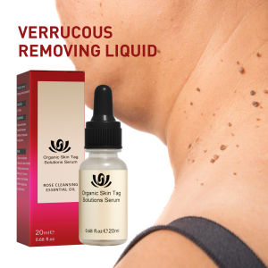 Skin Tag Remover Penghilang Kutil Tanpa Luka Serum Perbaikan Flek Hitam Memudarkan Flek Memutihkan Tanpa Bekas 20ml
