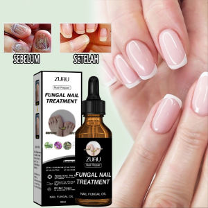 Nail Repair Essence Serum Original Serum Kuku | Perawatan Kuku Berjamur | Serum Penghilang Jamur Di Kuku | Vitamin Kuku Rusak | Memperbaiki Kuku Rusak 30ML