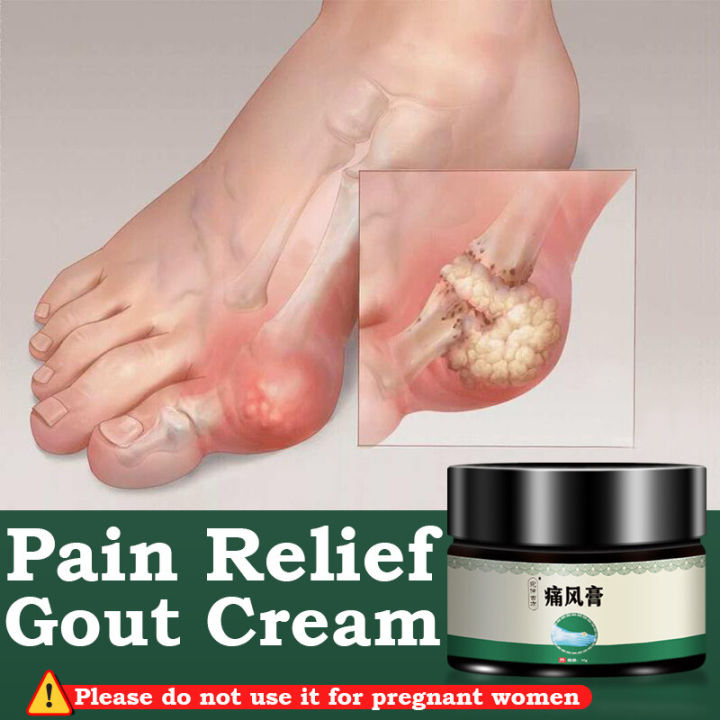 Gout Pain Relief Cream Gout Treatment Cream Arthritis Rheumatism Pain ...