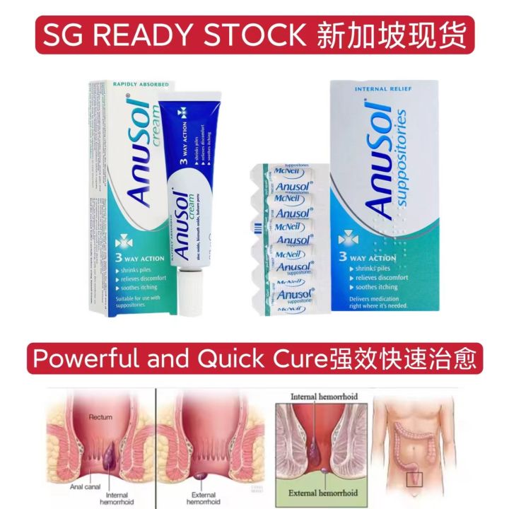 England Brand Hemorrhoid Ointment / Cream Suppository 英国牌 痔疮膏 痔疮栓 Powerful and quick cure for constipation 快速治疗恢复痔疮