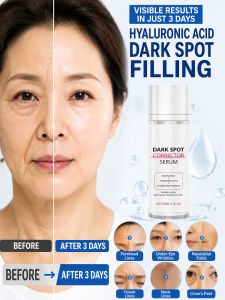 ✨ Whitening Cream for Anti-Freckle Brightening Anti-Wrinkle Hydration / Three-in-One Skin Rejuvenation Cream / Whitening Moisturizer / Spot Removal / Anti-Aging Cream  3-in-1 Skin Rejuvenating Cream for Anti-Freckle Brightening Anti-Wrinkle
