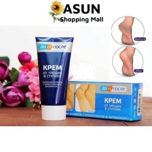 Kem Ngăn Ngừa Và Hồi Phục Nứt Nẻ Gót Chân Kpem Nga 50ml
