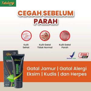 salep gatal kulit paling ampuh - salep gatal selangkangan paling ampuh - salep gatal ampuh - salep penghilang bekas luka koreng hitam - salep penghilang flek hitam membandel - salep penghilang bekas luka hitam lama
