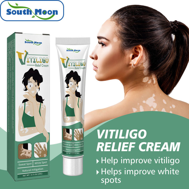 South Moon Vitiligo Relief Cream Vitiligo Ointment Remove Ringworm ...