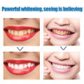 JIORNIEE Pasta Gigi 100g - Pasta Gigi Odol Pemutih Gigi Pembersih Karang Gigi - Whitening Toothpaste. 