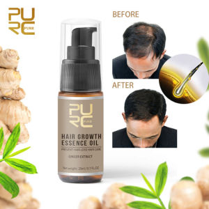 PURC 100% Pure Natural Hair Growth Oil ขิงผม Treatment ที่มีประสิทธิภาพป้องกันผมร่วง Fast ที่มีประสิทธิภาพ Growing Hair Serum Liquid Hair Grower สำหรับผู้ชาย Original Thickener Hair Care Essence 20Ml