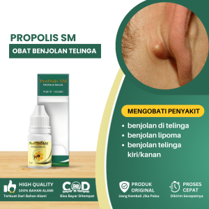Obat Benjolan Di Belakang TelingaObat Benjolan Di Telinga Sebelah Kanan/Kiri Obat Benjolan Lipoma Telinga Sakit Obat Benjolan Kecil Obat Benjolan Besar Penghancur Benjolan - Propolis SM