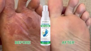 Foot Tea Tree Oil Spray - Odor Control & Itch Relief with Tea Tree Oil 120ml (4oz) Natural Foot Deodorizer for Fresh Clean Feet.