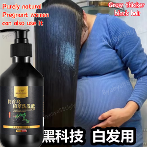 Hair Tonic hair growth spray 100ml white hair turns black serum hair loss treatment Improve hair follicles Nourish hair roots 100ml Repair activation hair growth Herbal essence nutrition 同仁堂生发精华液 防脱发 白发变黑发