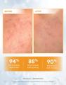 Somethinc 5% Niacinamide+Moisture Sabi Beet Serum 20Ml 114775791. 