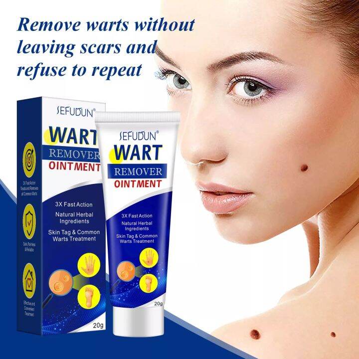 Wart Removal Cream Ubat Buang Kutil Ketuat Tahi Lalat Biji Kolestrol