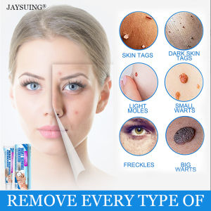 [Fire] Wart removal cream repairs ordinary Yukes body face and neck painless wart removal cream ointment remover skin blemish remover