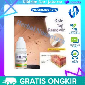 Wart Removal - Penghilang Kutil di Leher - Obat Kutil di Leher - Obat Penghilang TahiLalat di Wajah - Skin Tag Penghilang Kutil