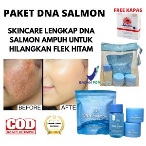 Paket Skincare DNA Salmon SR12 Premium Anti-Pencernaan dengan Kandungan Peptida & Kolagen untuk Kulit Sensitif