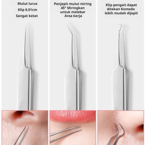 High Precision Stainless Steel Closed